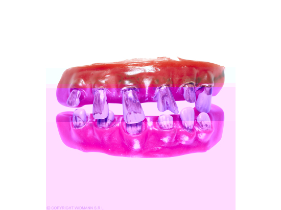 DENTURE DE VIEILLARD